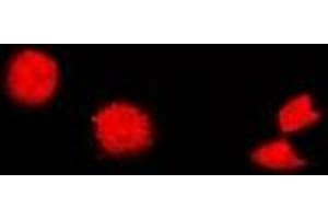 Immunofluorescent analysis of Cholinesterase staining in U2OS cells. (Butyrylcholinesterase anticorps)