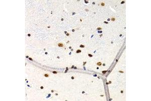 Immunohistochemistry of paraffin-embedded rat brain using MT2A antibody (ABIN1873764) at dilution of 1:200 (40x lens). (MT2A anticorps)