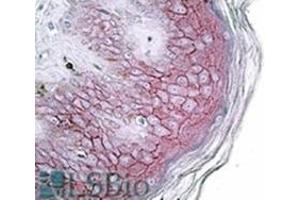 AP31715PU-N DSG1 antibody staining of paraffin embedded Human skin at 3. (Desmoglein 1 anticorps  (Internal Region))