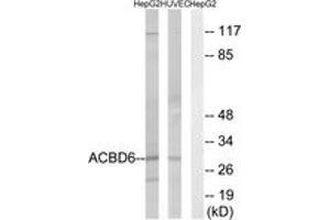 Western blot analysis of extracts from HepG2/HuvEc cells, using ACBD6 Antibody. (ACBD6 anticorps  (AA 121-170))