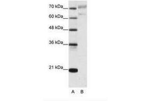 Image no. 1 for anti-Apoptosis Antagonizing Transcription Factor (AATF) (N-Term) antibody (ABIN202765) (AATF anticorps  (N-Term))