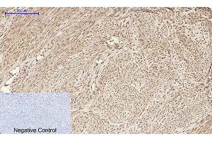 Immunohistochemical analysis of paraffin-embedded human uterus tissue. (HMGB1 anticorps  (N-Term))