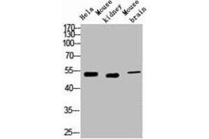 Western blot analysis of 1) Hela, 2) Mouse Kidney, 3) Mouse Brain, diluted at 1:2000.