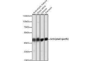 Western blot analysis of extracts of various cell lines, using Actin (plant specific) antibody (ABIN1513383, ABIN1684226, ABIN1684286 and ABIN5663539) at 1:5000 dilution.