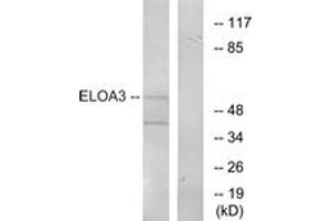 Western blot analysis of extracts from COLO205 cells, using ELOA3 Antibody. (TCEB3C anticorps  (AA 381-430))