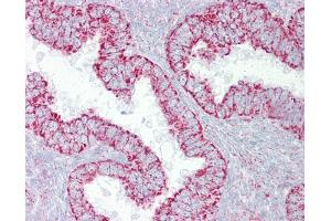 Anti-PDGFB antibody IHC of human uterus. (PDGF-BB Homodimer (N-Term) anticorps)