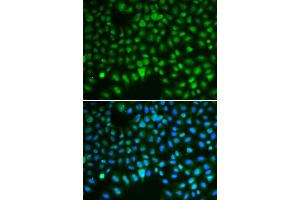 Immunofluorescence (IF) image for anti-Discs, Large (Drosophila) Homolog-Associated Protein 5 (DLGAP5) (AA 547-846) antibody (ABIN3023190) (DLGAP5 anticorps  (AA 547-846))