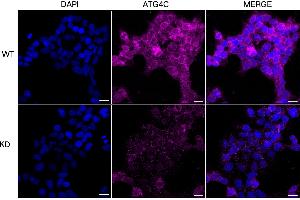 Immunocytochemical staining of HeLa cells using ATG4C antibody (ABIN7797712), 1:1,000), Top panel: wild-type (WT), Bottom panal: ATG4C shRNA knockdown (KD).
