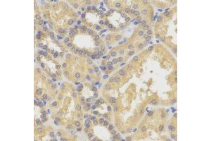 Immunohistochemistry (IHC) image for anti-SMYD Family Member 5 (SMYD5) antibody (ABIN1882323)