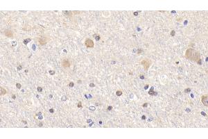 Detection of Bid in Human Cerebrum Tissue using Polyclonal Antibody to BH3 Interacting Domain Death Agonist (Bid) (BID anticorps  (AA 1-195))