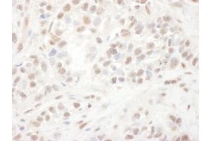 Immunohistochemistry (IHC) image for anti-ELK1, Member of ETS Oncogene Family (ELK1) (AA 200-250) antibody (ABIN7454491) (ELK1 anticorps  (AA 200-250))