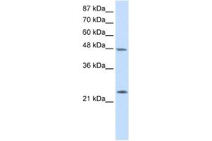 Western Blot showing CBX6 antibody used at a concentration of 1-2 ug/ml to detect its target protein. (CBX6 anticorps  (N-Term))