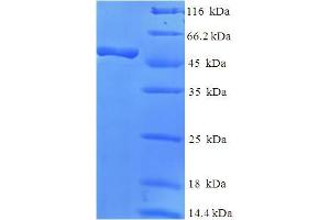 SDS-PAGE (SDS) image for Rabphilin 3A-Like (Without C2 Domains) (RPH3AL) (AA 1-315), (full length) protein (His-SUMO Tag) (ABIN5711959) (RPH3AL Protein (AA 1-315, full length) (His-SUMO Tag))
