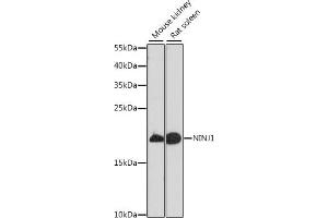 Western blot analysis of extracts of various cell lines, using NINJ1 antibody (ABIN7268918) at 1:1000 dilution.