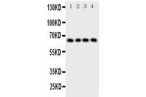 Western Blotting (WB) image for anti-Parathyroid Hormone 1 Receptor (PTH1R) (AA 388-406), (C-Term) antibody (ABIN3043983) (PTH1R anticorps  (C-Term))