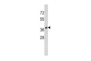Western blot analysis of SRC Antibody (C-term) (ABIN390705 and ABIN2840989) in Y79 cell line lysates (35 μg/lane).