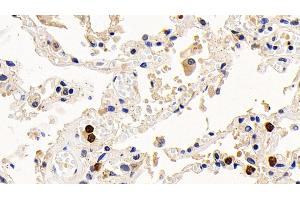 Detection of Bcl2L in Human Lung Tissue using Monoclonal Antibody to B-Cell CLL/Lymphoma 2 Like Protein (Bcl2L)