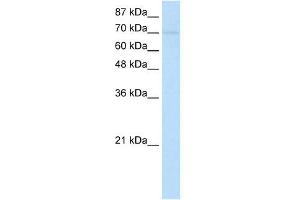 WB Suggested Anti-ZNF282 Antibody Titration:  1. (ZNF282 anticorps  (N-Term))