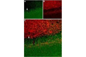 Expression of SSTR2 in rat hippocampus - Immunohistochemical staining of rat hippocampus using Anti-Somatostatin Receptor Type 2 (extracellular) Antibody (ABIN7043765, ABIN7045268 and ABIN7045269).