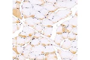 Immunohistochemistry of paraffin embedded rat Skeletal muscle using Troponin I f(ABIN7076031) at dilution of 1:700 (400x lens) (TNNI2 anticorps)