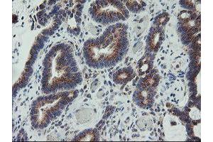 Image no. 8 for anti-Archain 1 (ARCN1) antibody (ABIN1497572)