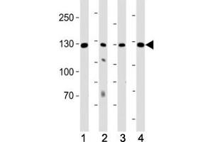 Western blot analysis of lysate from (1) K562 cell line, (2) human lung, (3) mouse kidney and (4) mouse heart tissue using ROR1 antibody at 1:1000. (ROR1 anticorps)