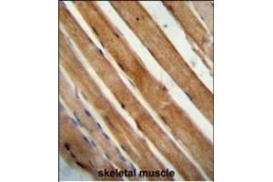 SLC25A12 antibody (N-Term) (ABIN654231 and ABIN2844065) immunohistochemistry analysis in formalin fixed and paraffin embedded human skeletal muscle followed by peroxidase conjugation of the secondary antibody and DAB staining.