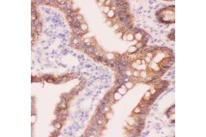 Anti-CTNNA1 Picoband antibody,  IHC(P): Rat Intestine Tissue (CTNNA1 anticorps  (AA 143-292))