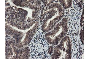 Image no. 10 for anti-Tryptophan 2,3-Dioxygenase (TDO2) antibody (ABIN1501352)