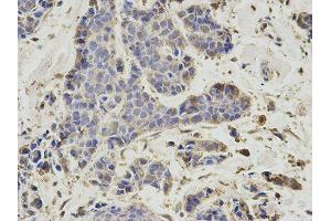 Immunohistochemistry (IHC) image for anti-Proteasome (Prosome, Macropain) 26S Subunit, Non-ATPase, 7 (PSMD7) antibody (ABIN1876544) (PSMD7 anticorps)
