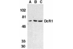 Western blot analysis of DcR1 in HeLa cell (A), mouse (B) and rat (C) liver tissue lysates with AP30279PU-N DcR1 antibody at 1 μg/ml. (DcR1 anticorps)
