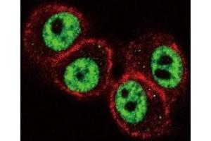 anti-Runt-Related Transcription Factor 1 (RUNX1) (AA 227-255) antibody