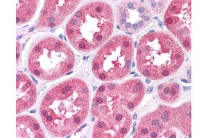 Immunohistochemistry (IHC) image for anti-Dihydrolipoamide Branched Chain Transacylase E2 (DBT) (N-Term) antibody (ABIN2784728)