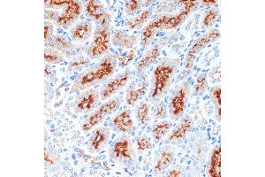 Immunohistochemistry of paraffin-embedded mouse kidney using Syntaxin 3 Rabbit mAb (ABIN7270686) at dilution of 1:100 (40x lens).