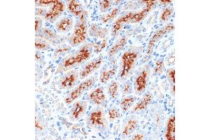 Immunohistochemistry of paraffin-embedded mouse kidney using Syntaxin 3 Rabbit mAb (ABIN7270686) at dilution of 1:100 (40x lens). (STX3 anticorps)