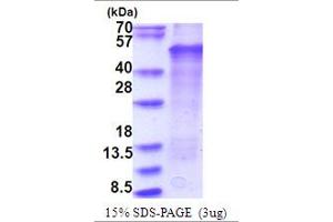 SDS-PAGE (SDS) image for LIM Homeobox Transcription Factor 1, beta (LMX1B) (AA 1-395) protein (His tag) (ABIN5853769)