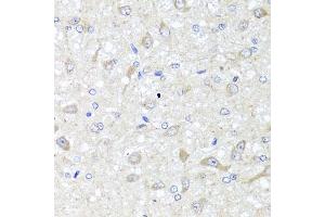 Immunohistochemistry of paraffin-embedded rat brain using IL33 antibody (ABIN5995447) at dilution of 1/100 (40x lens). (IL-33 anticorps)
