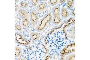 Immunohistochemistry of paraffin-embedded mouse kidney using RPS2 antibody at dilution of 1:100 (x40 lens). (RPS2 anticorps)