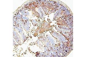 IHC analysis of RAB27A using anti-RAB27A antibody (ABIN7602714). (RAB27A anticorps  (AA 98-216))