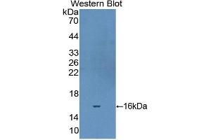 Western Blotting (WB) image for anti-Fibronectin (AA 2206-2337) antibody (ABIN1980400)
