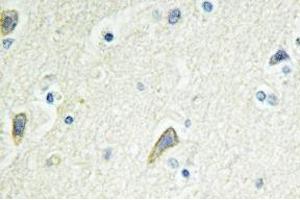Immunohistochemistry analysis of EphB4 Antibody in paraffin-embedded human brain tissue. (EPH Receptor B4 anticorps)