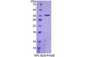 SDS-PAGE of Protein Standard from the Kit (Highly purified E. (HIF1A Kit CLIA)