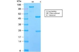 SDS-PAGE Analysis Purified NGFR Rabbit Recombinant Monoclonal Antibody (NGFR/2550R).