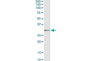 Immunoprecipitation of EPDR1 transfected lysate using anti-EPDR1 monoclonal antibody and Protein A Magnetic Bead , and immunoblotted with EPDR1 MaxPab rabbit polyclonal antibody.