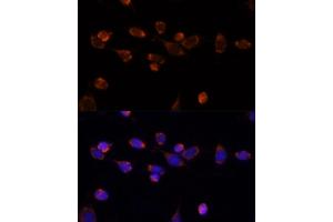 Immunofluorescence analysis of NIH/3T3 cells using PDH antibody (7432) at dilution of 1:100. (PDHA1 anticorps)