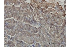 Immunoperoxidase of monoclonal antibody to RIPK2 on formalin-fixed paraffin-embedded human pancreas.