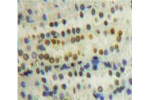 Used in DAB staining on fromalin fixed paraffin-embedded Kidney tissue