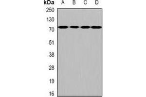 Western blot analysis of HPA2 expression in Hela (A), SKOV3 (B), mouse brain (C), rat brain (D) whole cell lysates.