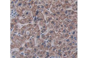 IHC-P analysis of Human Tissue, with DAB staining. (SIGLEC8 anticorps  (AA 70-336))