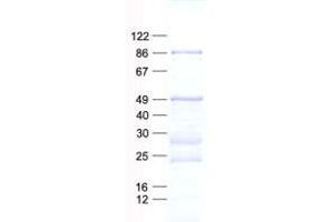 Validation with Western Blot (CCDC13 Protein (His tag))